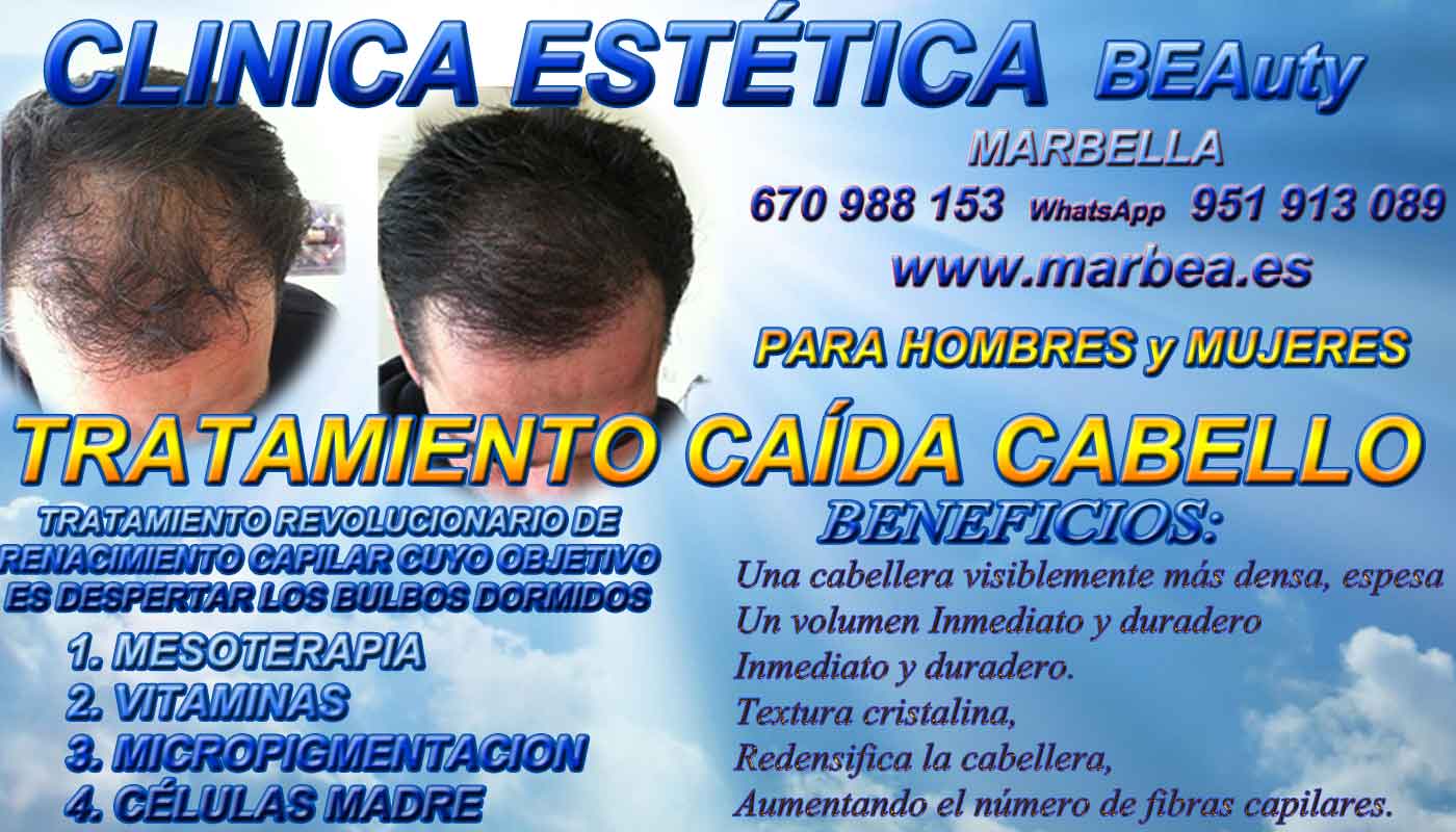 Implante cabello Clínica Estética y Injertos Cabello En Marbella y Málaga