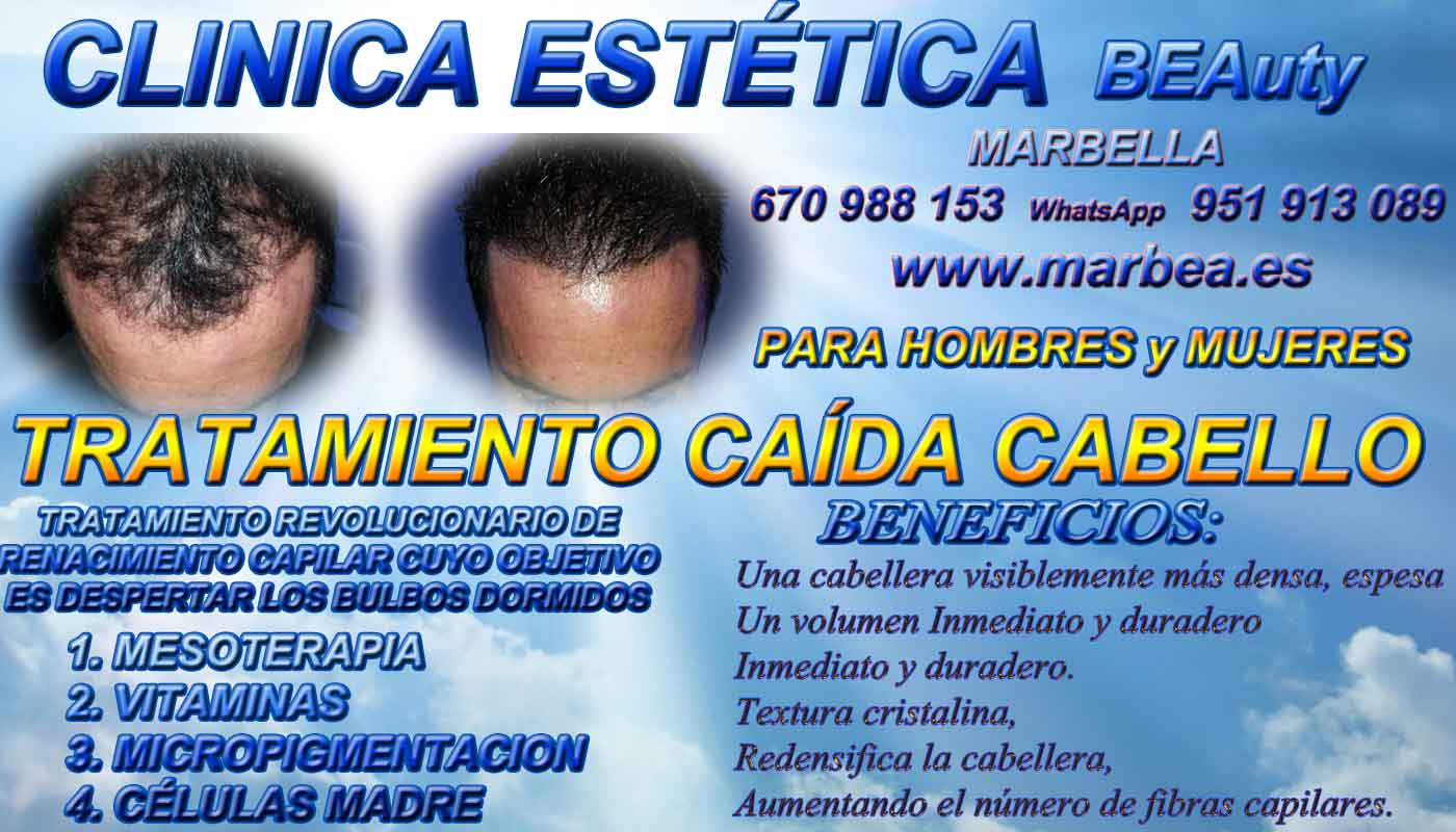 Implante cabello Clínica Estética y Injertos Cabello Marbella y Málaga