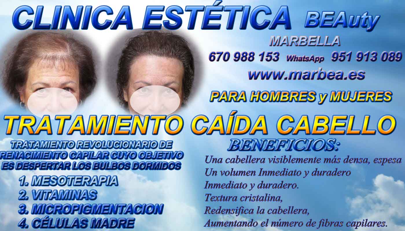 Implante cabello Clínica Estética y Injertos Cabello En Marbella y en Coin